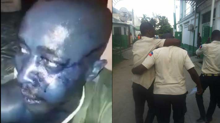 HAITI: Une attaque armée contre un commissariat aux Cayes a fait 5 morts ( VIDEO )