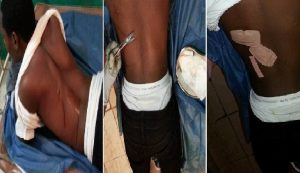 Haiti: Un jeune capois attaqué par des individus armés d’armes à feu et de machettes